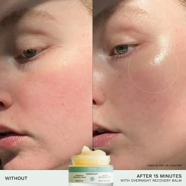 Хидратиращ нощен балсам REN EVERCALM OVERNIGHT RECOVERY BALM 30ml