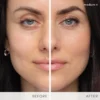 hydropuretintedserum beforeandafterjoanna m4 2000x Анти-ейдж тониращ серум за лице Jane Iredale HydroPure Tinted Serum with Hyaluronic Acid & CoQ10