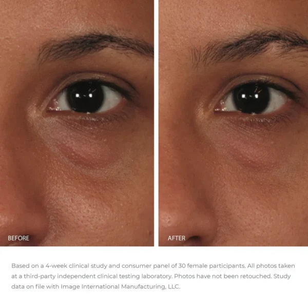Околоочен гел IMAGE Skincare Balancing Eye Lift Gel