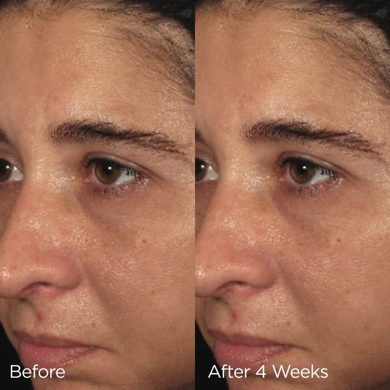 Подхранващ крем IMAGE Skincare Balancing Biopeptide Creme
