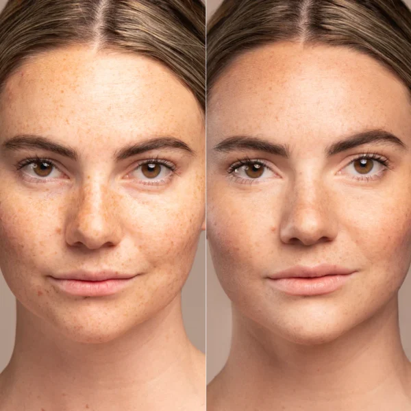 prevention sun serum spf 30 pdp r06 Безцветен слънцезащитен серум IMAGE Skincare PREVENTION+® Sun Serum SPF 30 Untinted